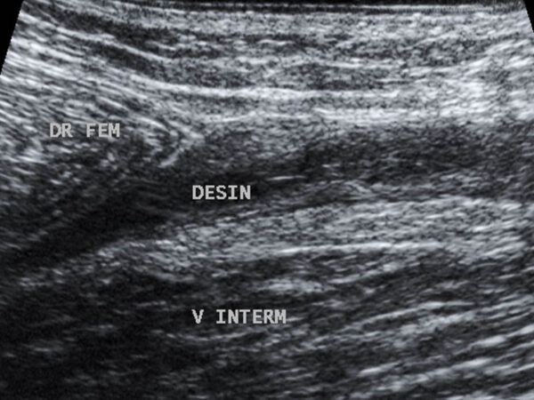 Archives des lésions musculaires Docteur Imago