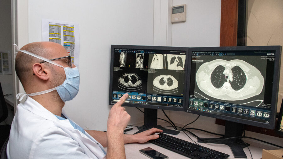Une Nouvelle Classification Tnm Pour Le Cancer Du Poumon Docteur Imago