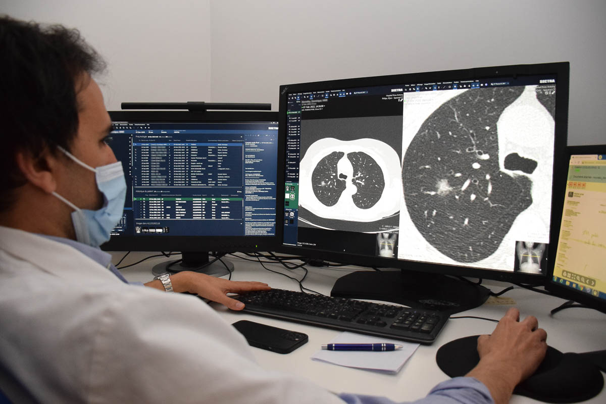 Reportage HPA Antony dépistage du cancer du poumon scanner