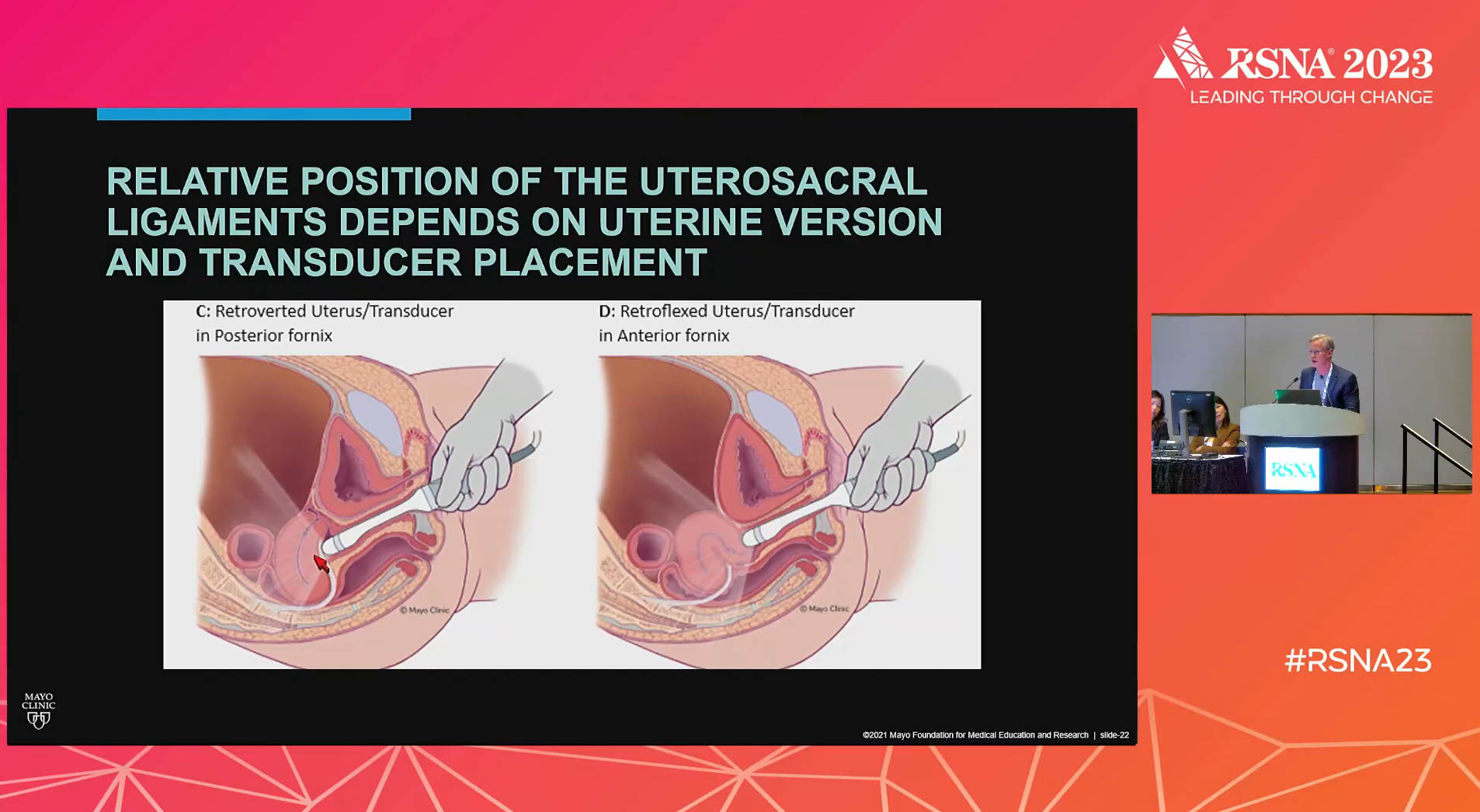 Le rôle central de l'échographie dans l'endométriose - Docteur Imago