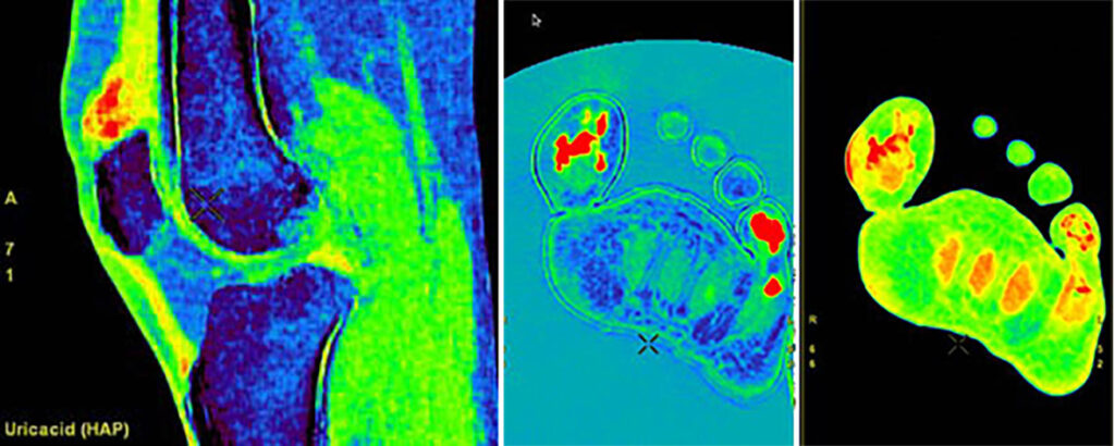 L imagerie Spectrale Au Service De L ost oarticulaire Les Pathologies l-imagerie-spectrale-au-service-de-l-ost-oarticulaire-les-pathologies