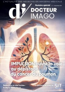 Numéro spécial DI dépistage du cancer du poumon